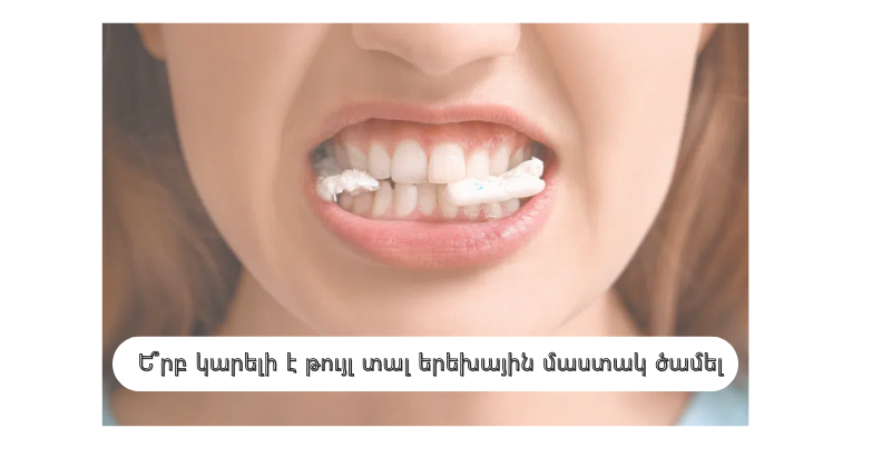 Մաստակ ծամելու ազդեցությունը երեխաների բերանի խոռոչի առողջության վրա