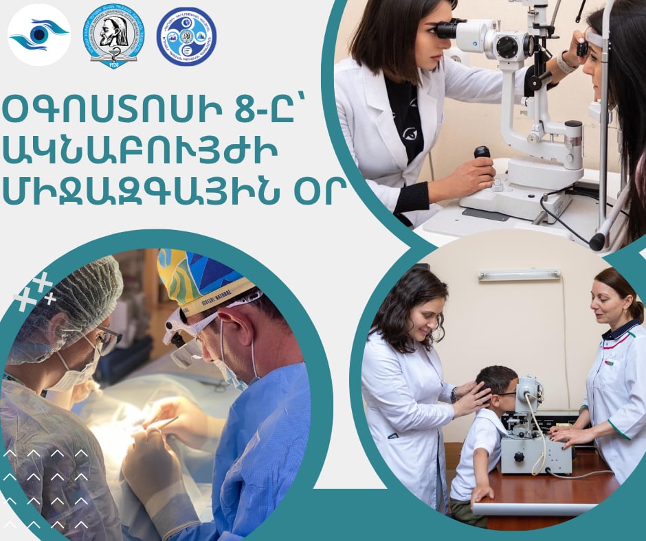 Օգոստոսի 8-ը՝ Ակնաբույժի միջազգային օր