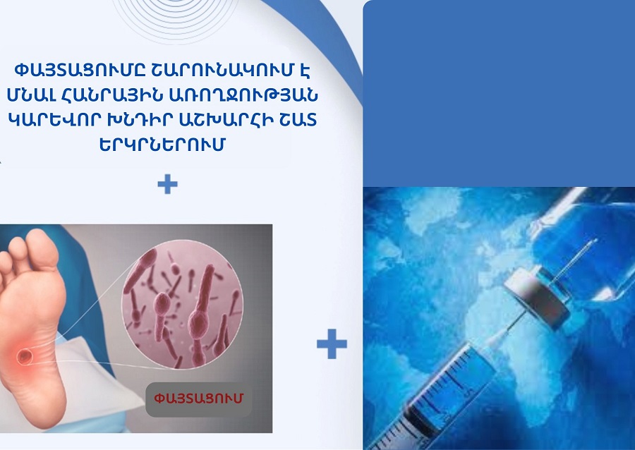 Փայտացումը՝ հանրային առողջության կարևոր խնդիր