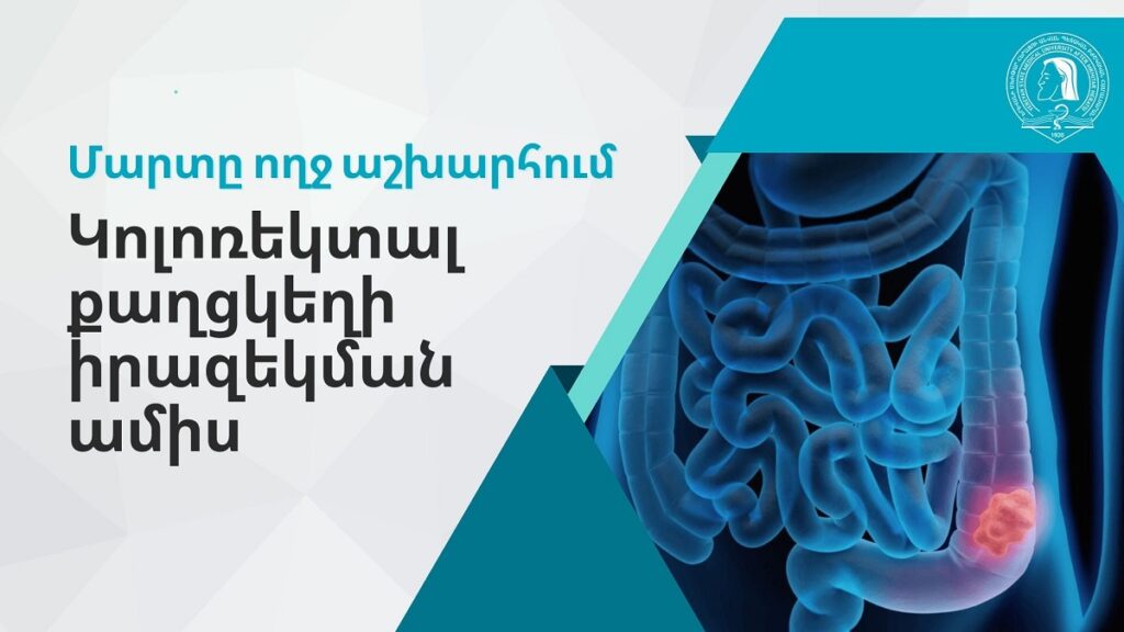 Հայաստանում կոլոռեկտալ քաղցկեղը ամենատարածված երեք քաղցկեղներից մեկն է