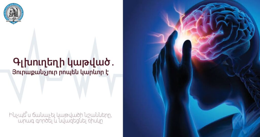 Գլխուղեղի կաթվածի համաշխարհային օր․ յուրաքանչյուր րոպեն կարևոր է